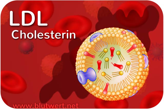 LDL-Cholesterin