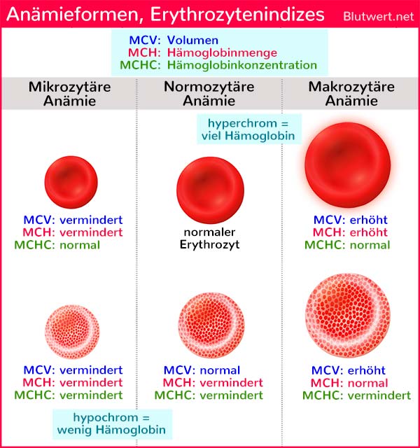 Erythrozytenindizes (MCV, MCH und MCHC) helfen beim Ermitteln der Ursache