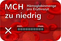 Zu wenig Hämoglobin in Erythrozyten: Blutwert MCH vermindert, zu niedrig