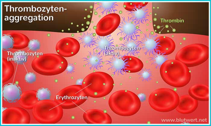 Thrombozytenaggregation: Wunde in einem Blutgefäß wird zügig geschlossen